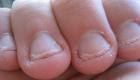 Почему люди грызут ногти?